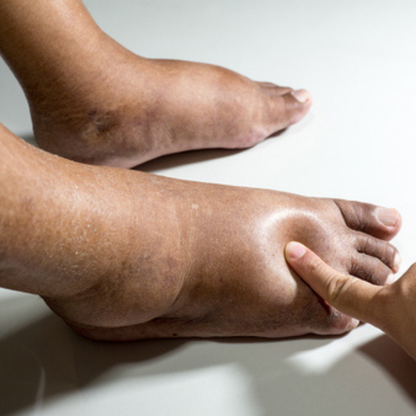 KINOKI: Patchs Détox pour un Corps Purifié