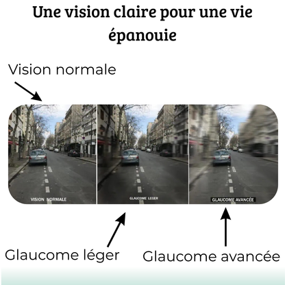 Vision Enhance Roller - Restaurez la Clarté et la Vitalité de votre Regard
