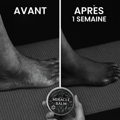 Baume Circulatoire Miracle Soulagement Intense