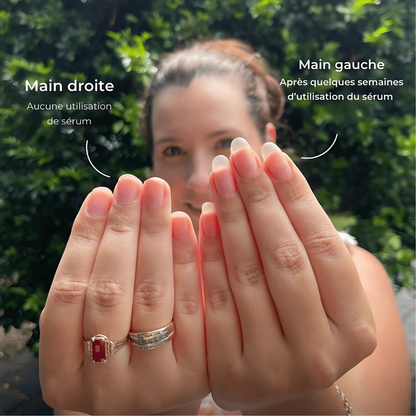 Sérum Croissance Ongles Miracle : Obtenez des Ongles Longs et Forts!