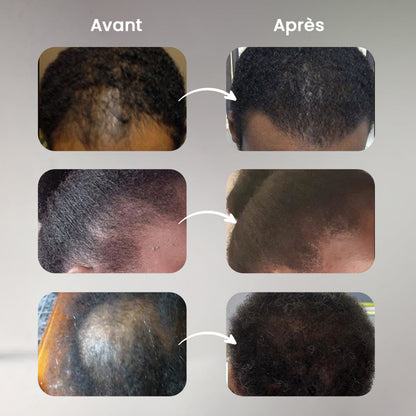 Fibres Capillaires Redensifiantes Instantanées